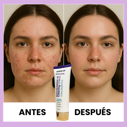 JABÓN NIACINAMIDA™ | SERUM 10